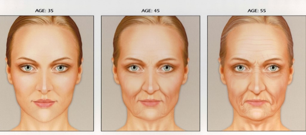 Preenchimento do terço médio da face com ácido hialurônico