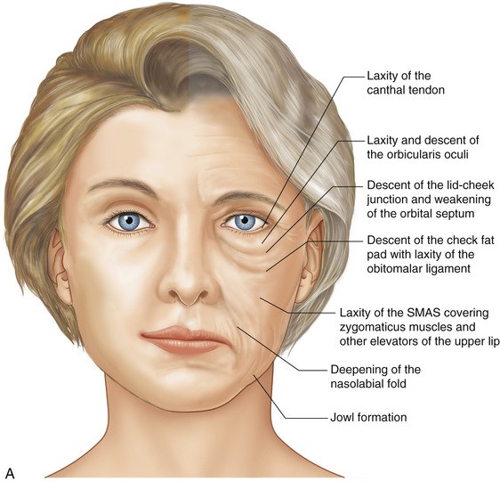 botox para queixo e canto da boca botox para queixo e canto da boca para DAO e mentalis