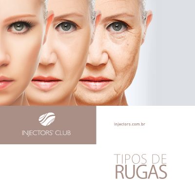 Tipos de rugas: rugas dinâmicas e rugas estáticas