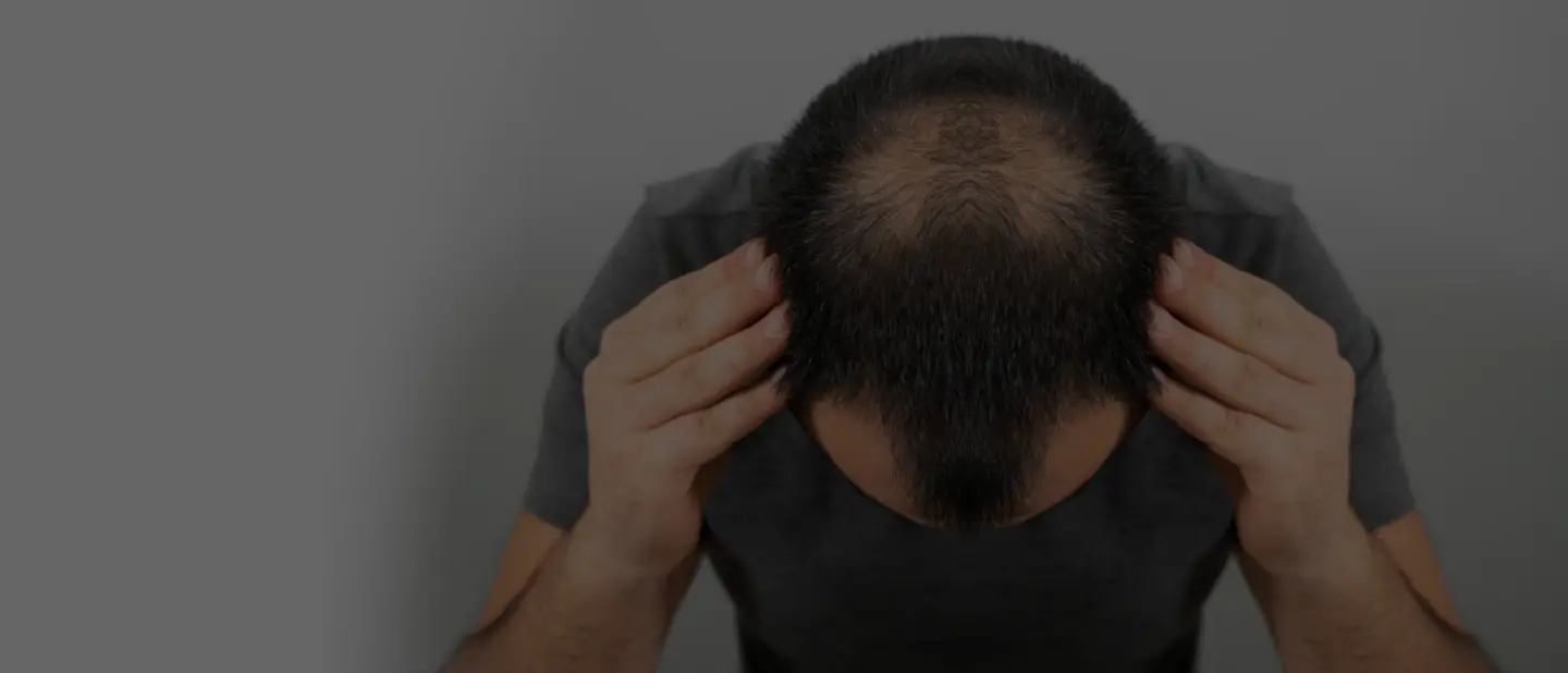 Mesclas para Cabelo
